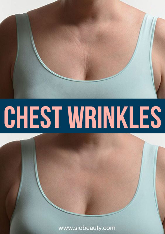 chest wrinkles remedies