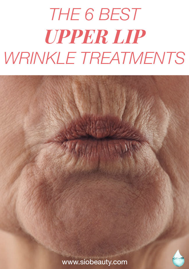 upper lip wrinkles