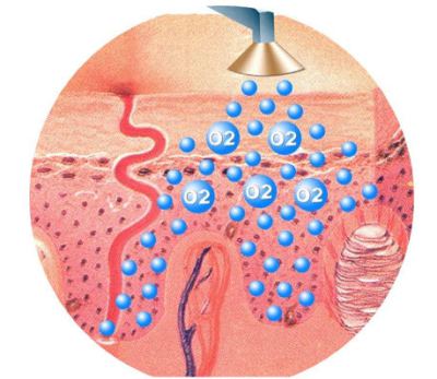 Ossigenoterapia, ricambio ossigeno