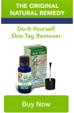 Skin Tag Remover