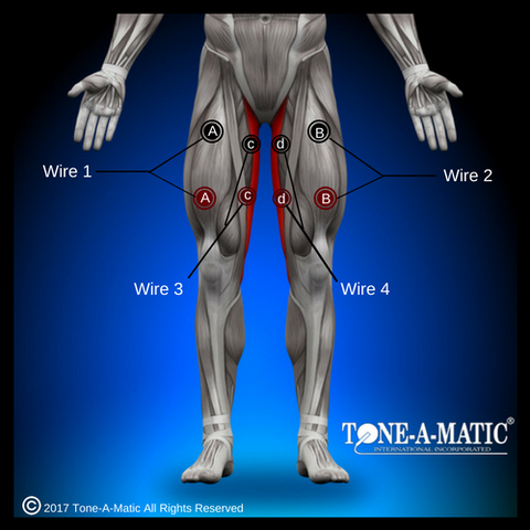 electrode pad placement chart for quadriceps and gracilis muscles