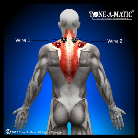 electrode pad placement for trapezius muscles