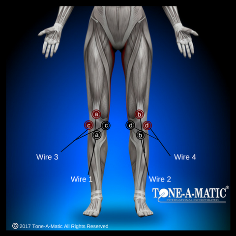 tens electrode pad placement chart for knee pain