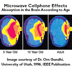 image of a brain being subjected to radiation from a cellphone