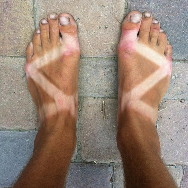 A man's feet shown after a summer of wearing Chacos. The straps make a defined X with fair skin surrounded by brown, tanned skin.