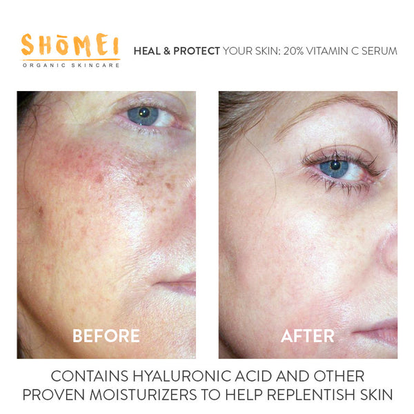 vitamin serum before face acid hyaluronic ferulic