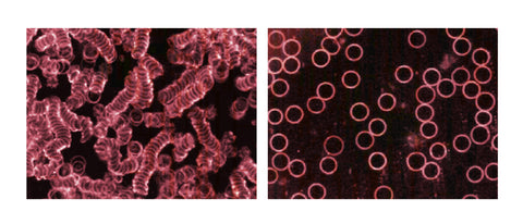 Dark-Field Blood Image With & Without Green 8 Evolution