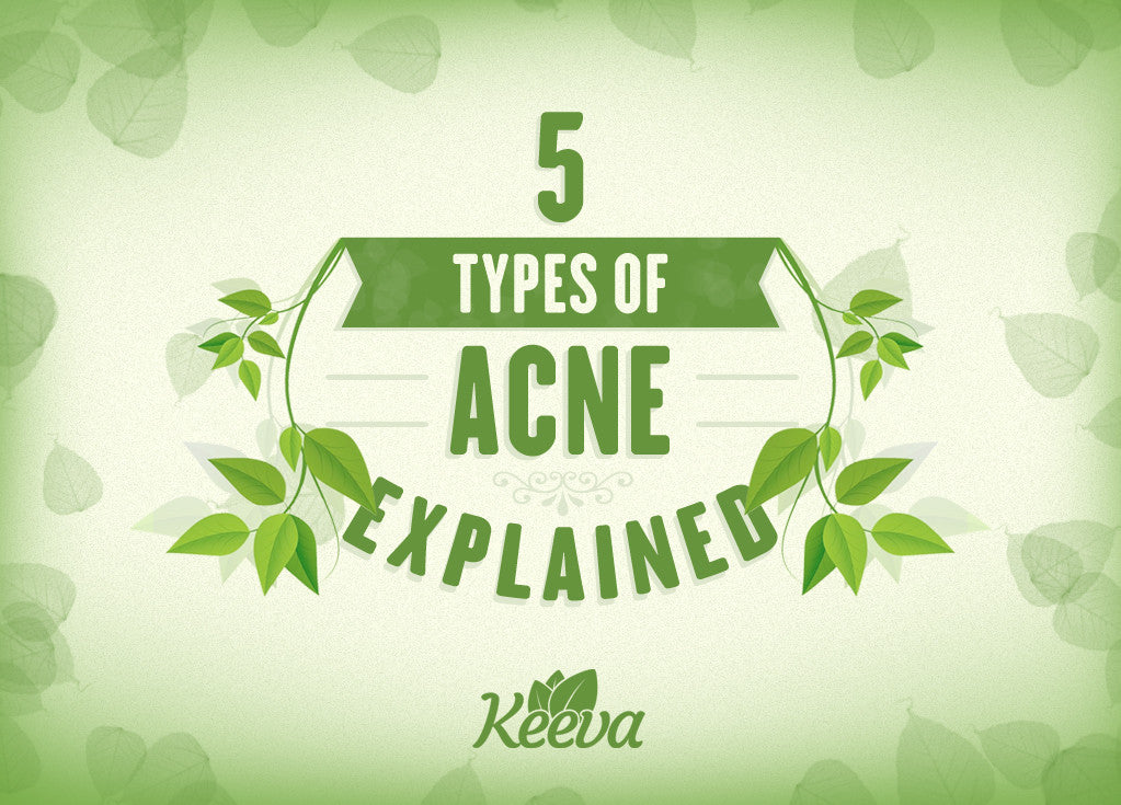 5 Types of Acne Explained and The Perfect Treatment Banner