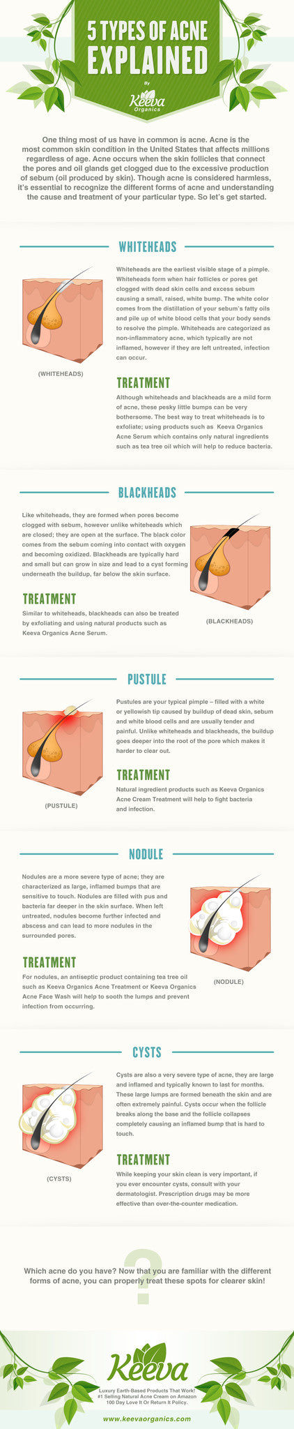 5 Types of Acne Explained and The Perfect Treatment Infographic
