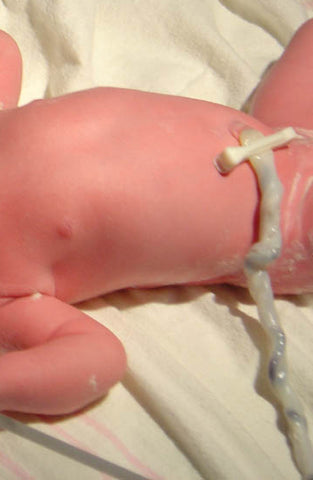 nurselet-umbilical-cord-newborn-baby-pediatrician-new-baby-breastfeeding-baby