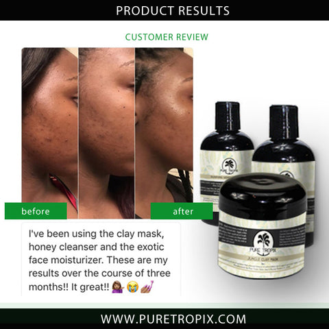 pure tropix stop ingrown hairs