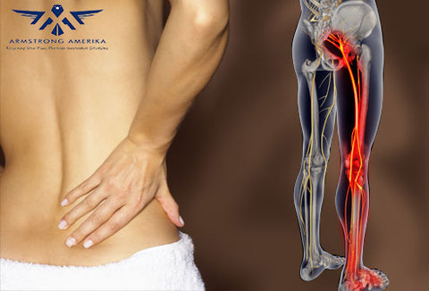 What is Sciatic Pain - best ways to treat it
