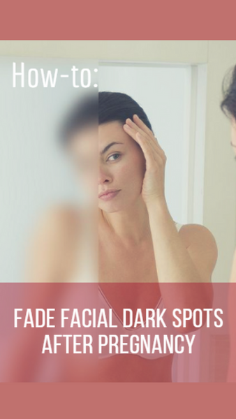 dark spots on face after pregnancy, dark skin after pregnancy | The Spoiled Mama