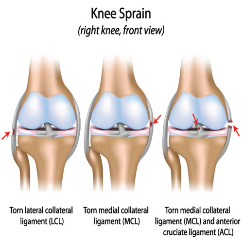 knee-injury