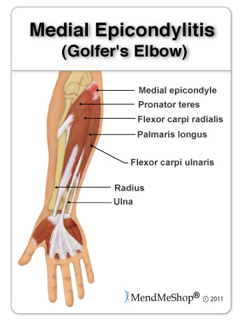 medial-epicondylitis-golfers-elbow