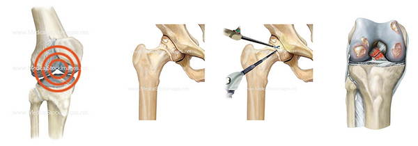Orthopedic Pictures Mix from Medical Stock Images Company