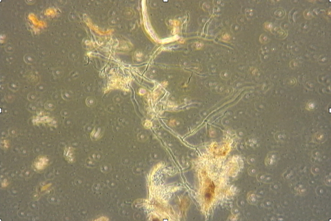 Fungal hyphae under my phase contrast microscope
