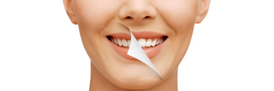 How Does Teeth Whitening Work?