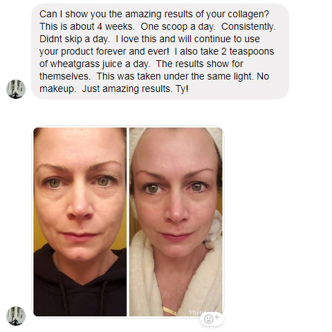 shelly collagen story