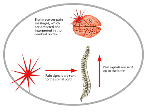 Pain signals