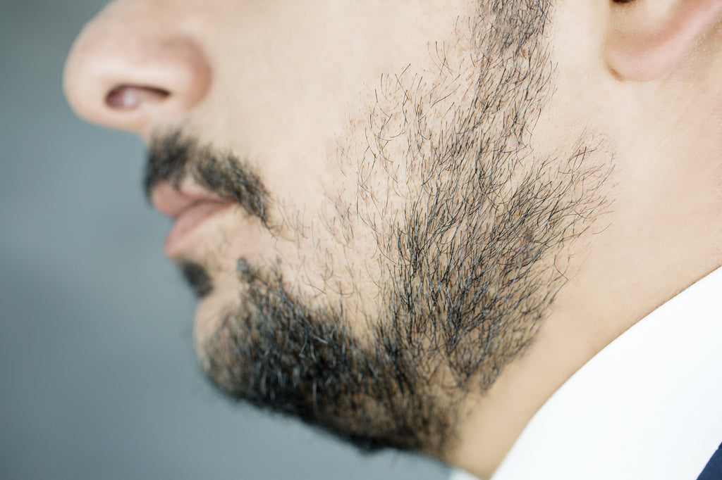 beard oil for patchy beards