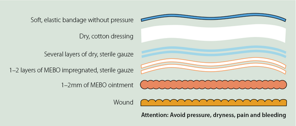 Dressing-wound-diagram