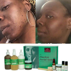 Removing Dark Spots