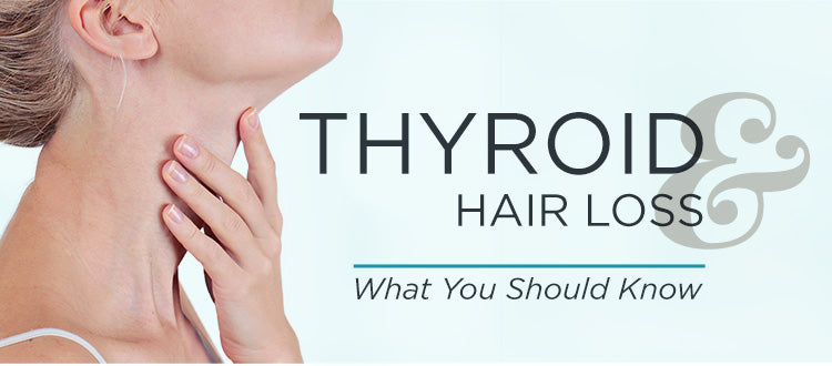Understanding Hypothyroidism Hair Loss Toppik And Viviscal Hair Blog Hairsolutionscanadaca
