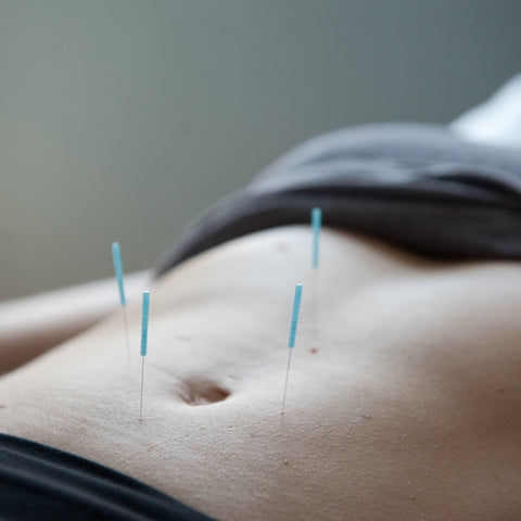 acupuncture for fertility