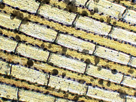 Rjave pikice oodinium na plavuti pod mikroskopom