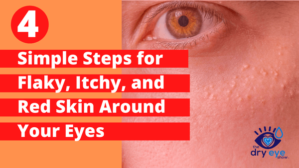 4 Simple Steps for Flaky, and Red Your Eyes - Eye Love