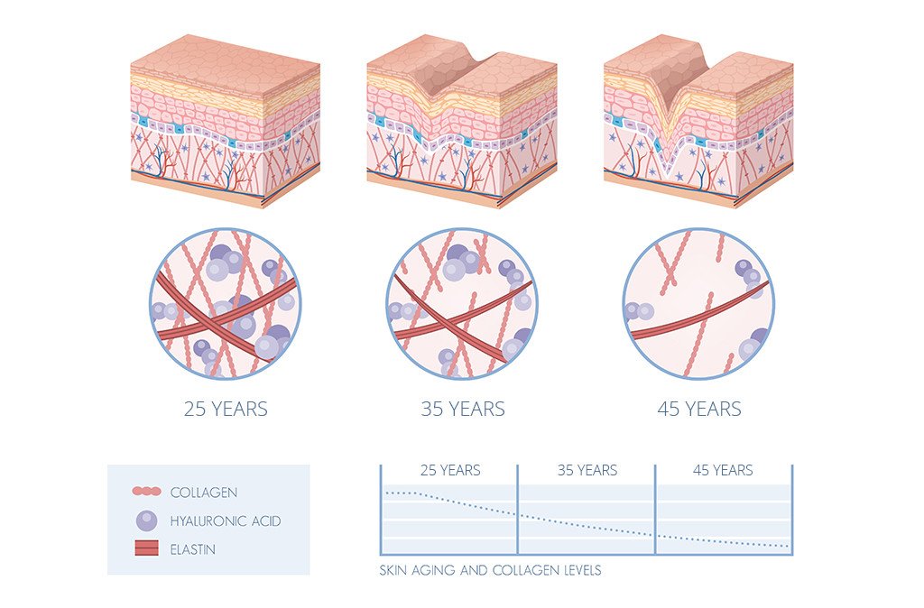 Decline in collagen levels in skin over time