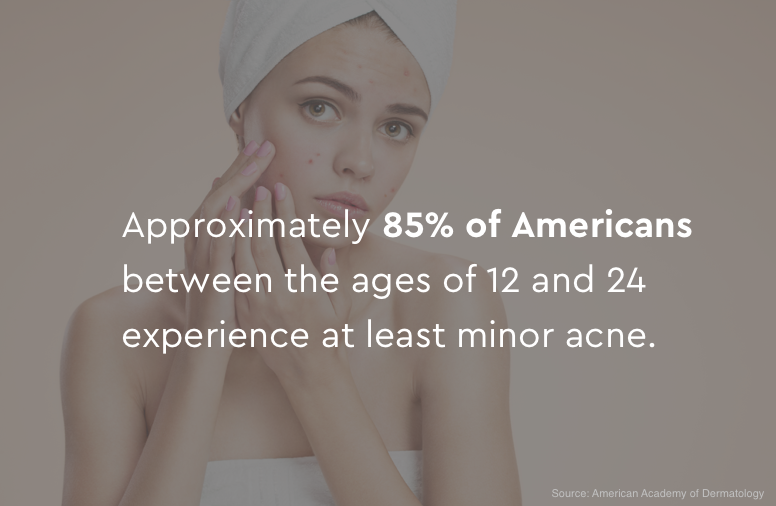 85% of Americans experience at least minor acne