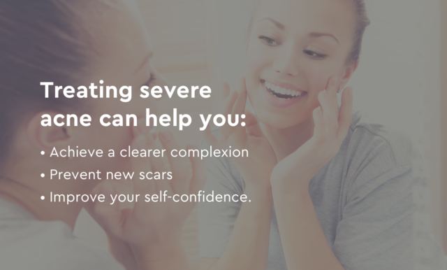 Treating severe acne can help you