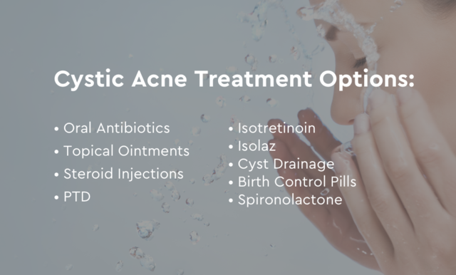 cystic acne treatment options