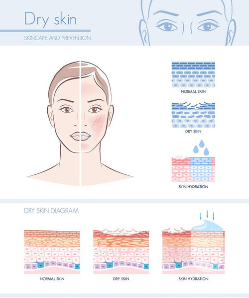 dry skin diagram