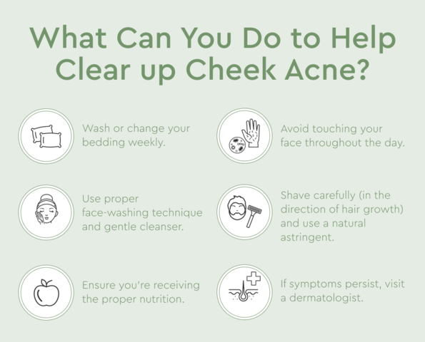 how to clear up cheek acne