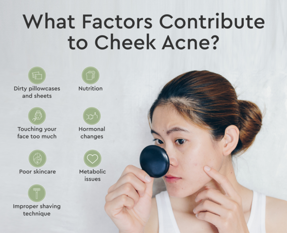 what causes cheek acne
