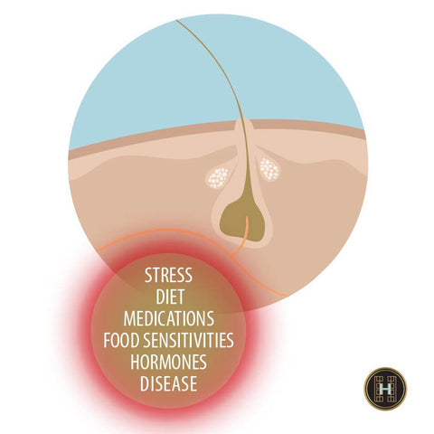 hair loss, thin hair, inflammation