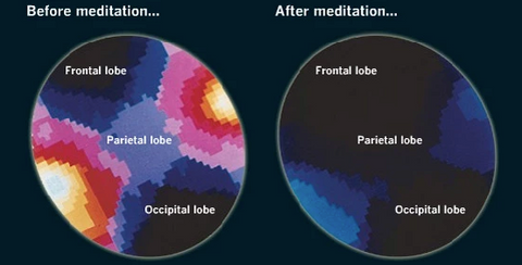 meditation in our brain