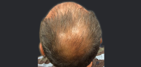 man before picture