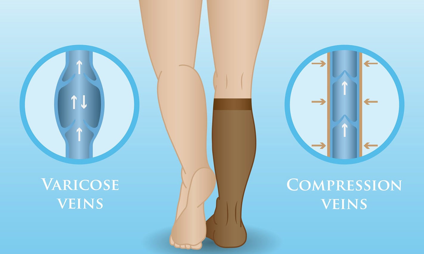 Why should I wear compression socks or compression stockings on shift as a nurse