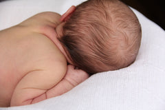 cradle cap