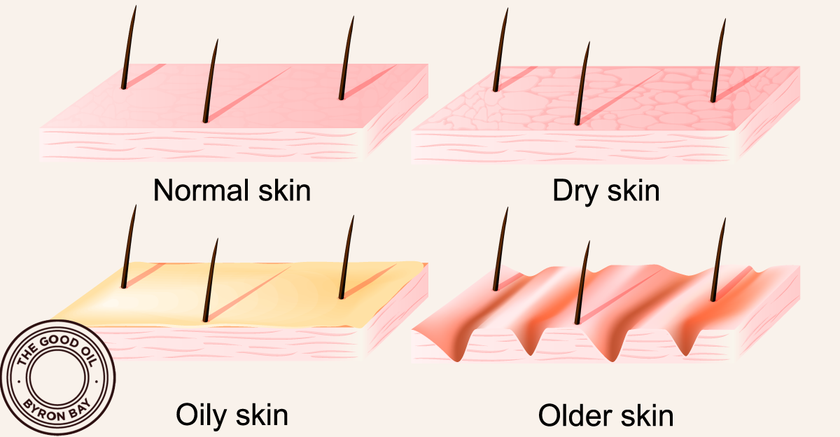The Good Oil Skin Types