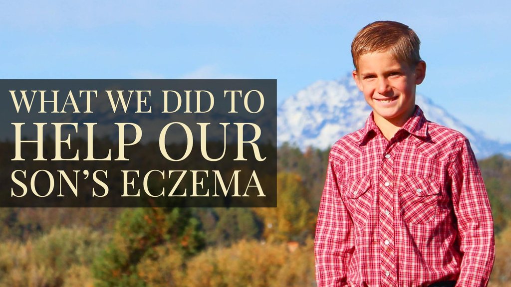 What We Did to Help Our Son’s Eczema - Bend Soap Company