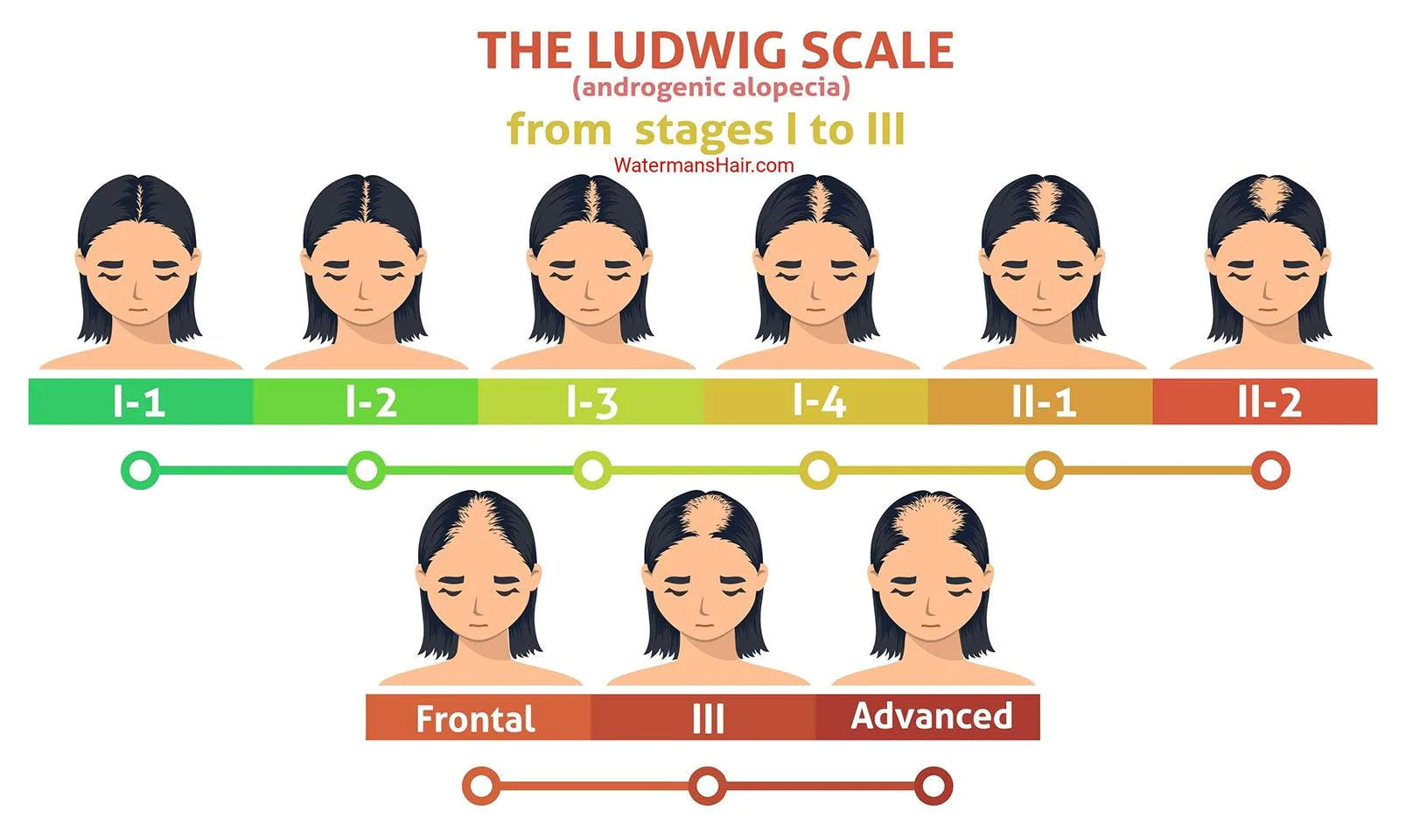 The Ludwig Scale For Female Hair Loss Watermans