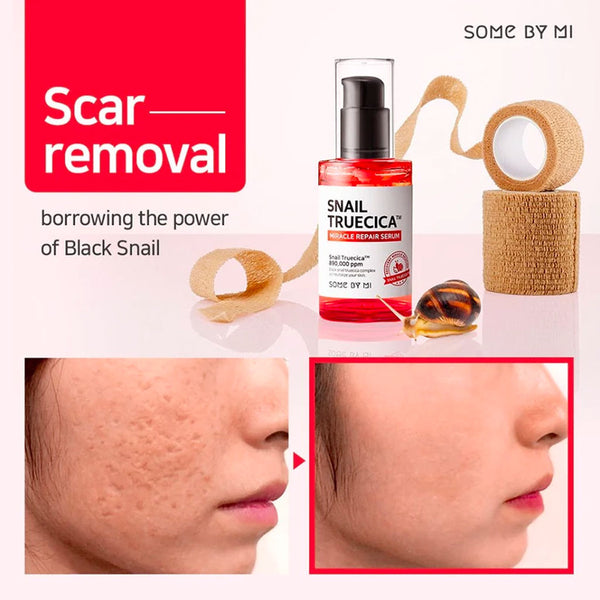 Some By Mi Snail Truecica Miracle Repair Serum Korean Snail Skincare Nudie Glow