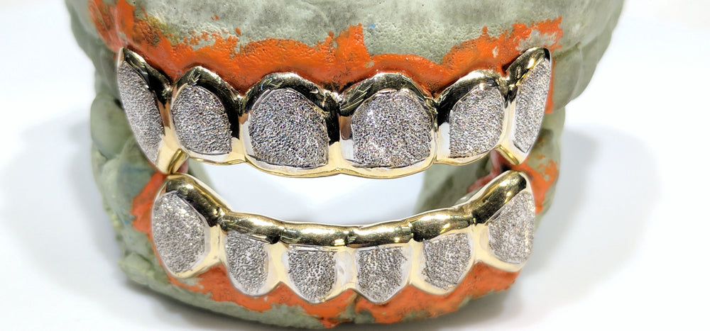 In the center: two bottom and top sets of custom made gold grills in 10 karat yellow gold with two tone rhodium plating high polish and diamond dust laser cut finish made by Popular Jewelry