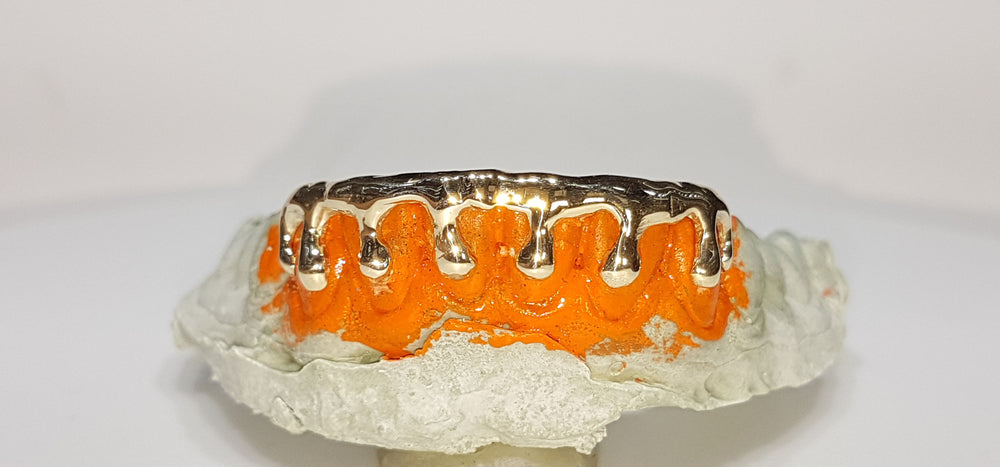 In the center: a set of custom made row of bottom 6 gold teeth grillz in solid 14 karat yellow gold drip style, high polish finish for Alessia Solimeo - Popular Jewelry