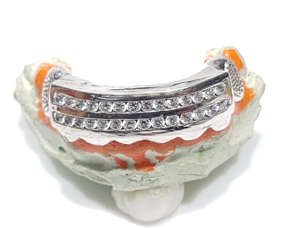 grills-grillz-gold-teeth-white-gold-two-channel-set-diamonds